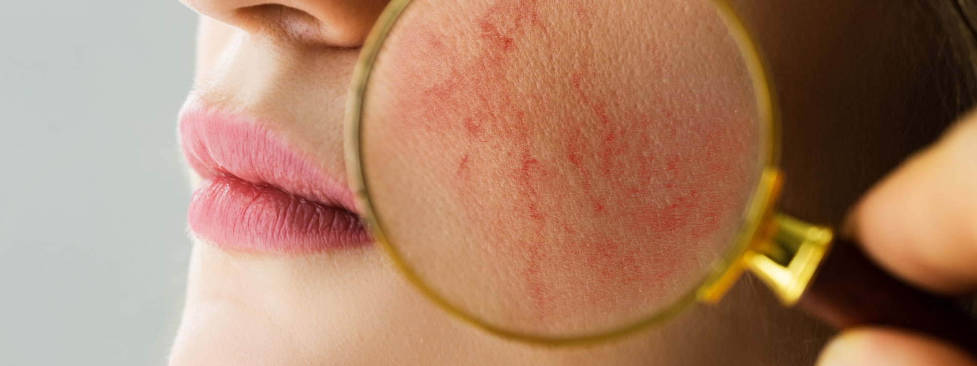 MVZ MADERMA GmbH Dermatologische Hautarztpraxis Goch