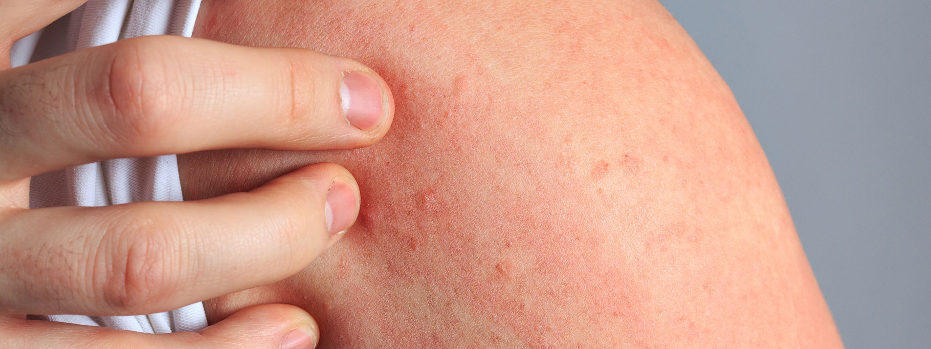 MVZ MADERMA GmbH Dermatologische Hautarztpraxis Goch