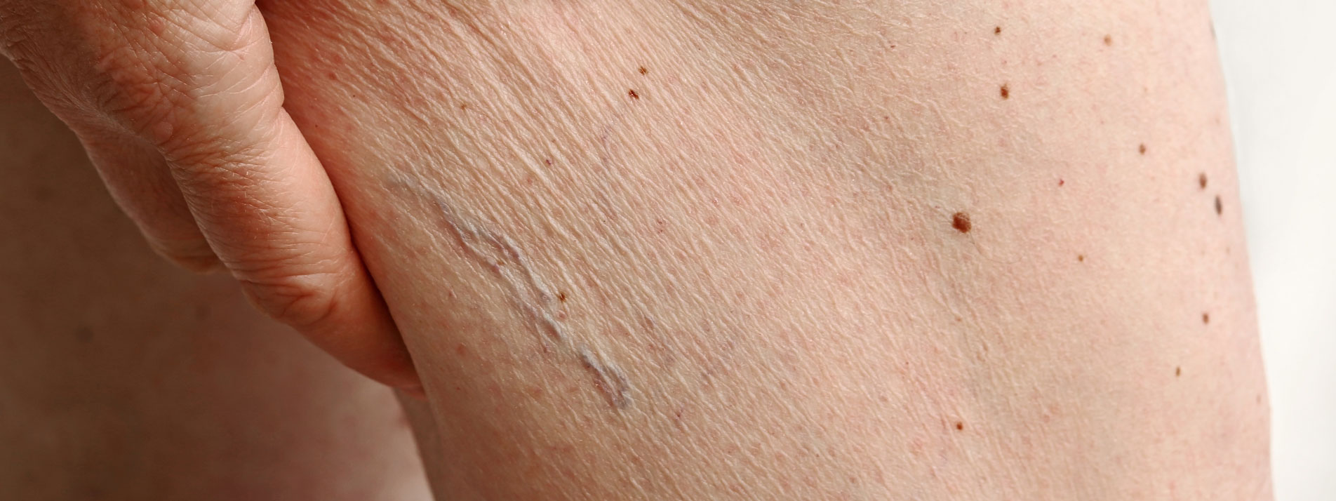 MVZ MADERMA GmbH Dermatologische Hautarztpraxis Goch